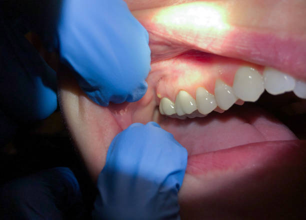 Best After-Hours Dental Trauma Care in Oxford, AL